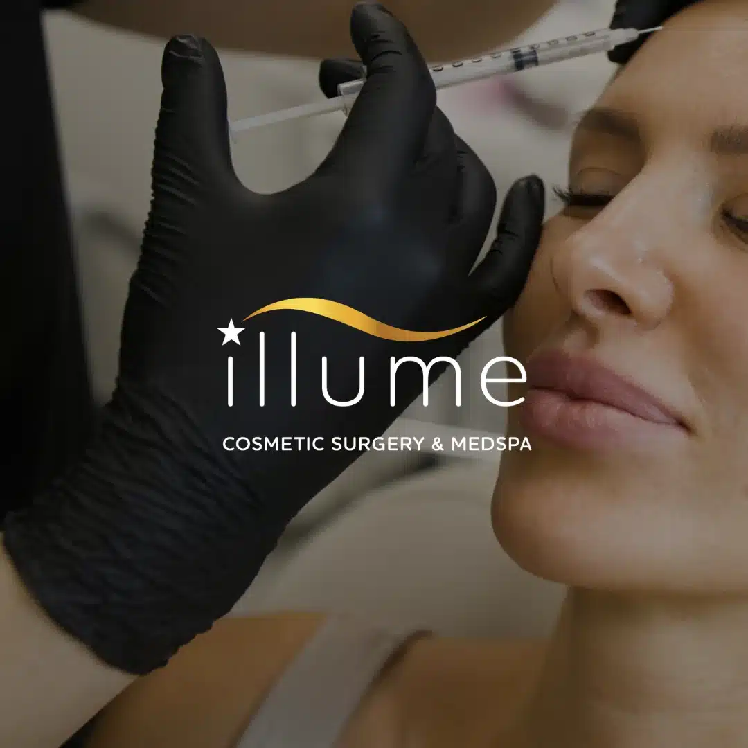 illume-cosmetic-surgery-medspa-featured-image